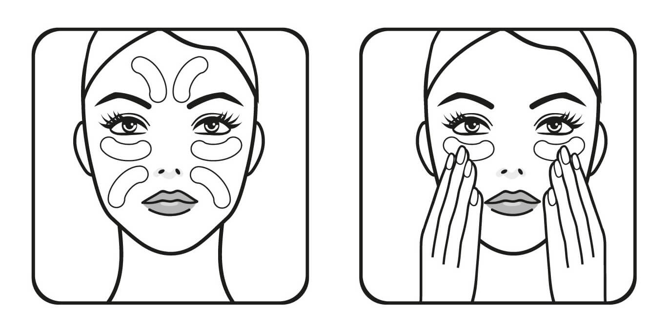 Przykład zaznaczonych miejsc zabiegowych na twarzy, na których należy przykleić plaster